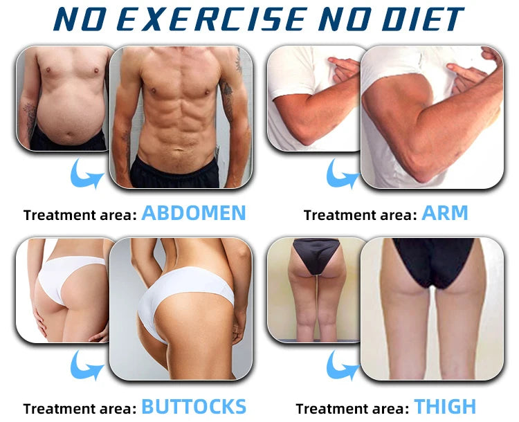 EMS Body Slimming Machine MuscleEMS Electrical Stimulation Muscle Sculpt Fat Burning Control Carving Weight Loss Machine