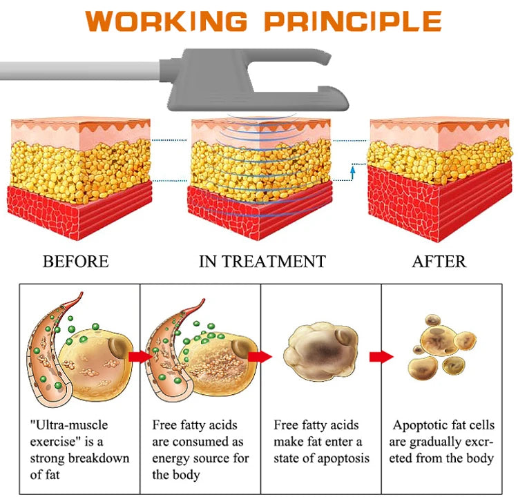 EMS Body Slimming Machine MuscleEMS Electrical Stimulation Muscle Sculpt Fat Burning Control Carving Weight Loss Machine