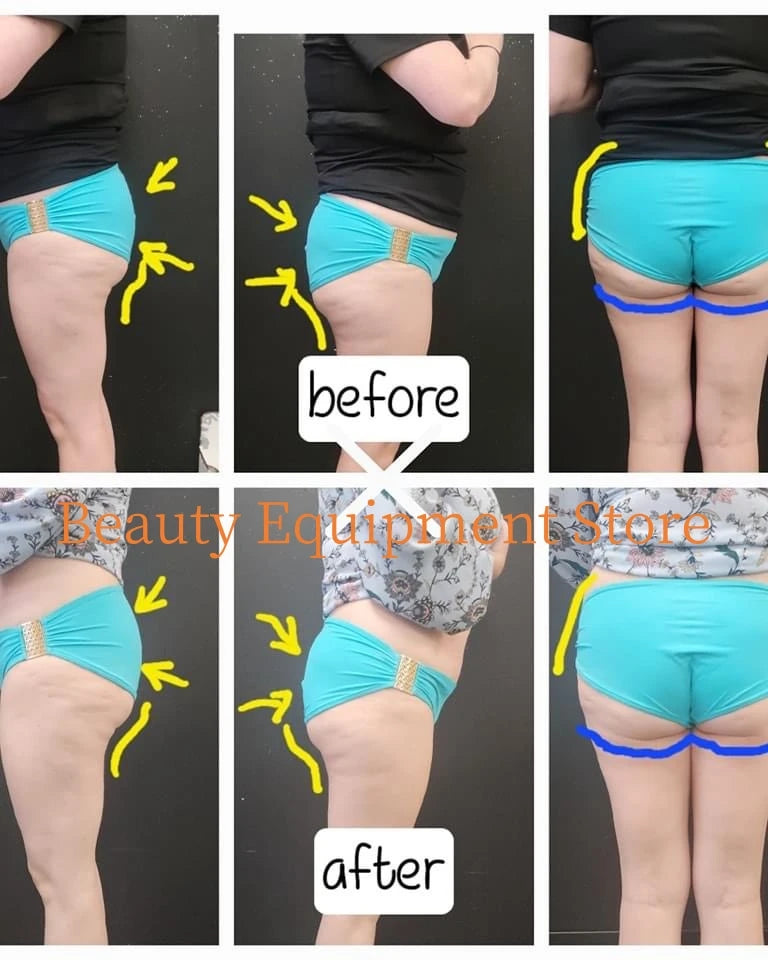 EMS Body Slimming Machine MuscleEMS Electrical Stimulation Muscle Sculpt Fat Burning Control Carving Weight Loss Machine